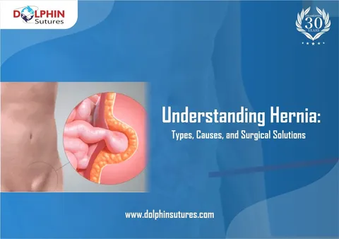 Understanding Hernia: Types, Causes, and Surgical Solutions