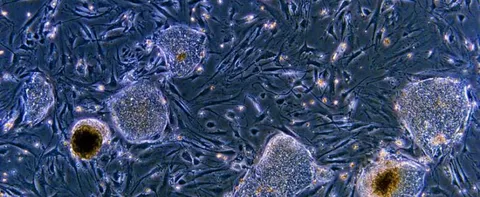 STUDENTS EMBED STEM CELLS IN SUTURES TO ENHANCE HEALING