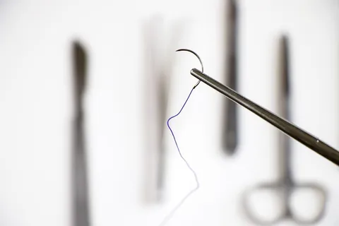 Surgical Staples vs. Sutures: A Technical Guide to Optimal Wound Closure Techniques