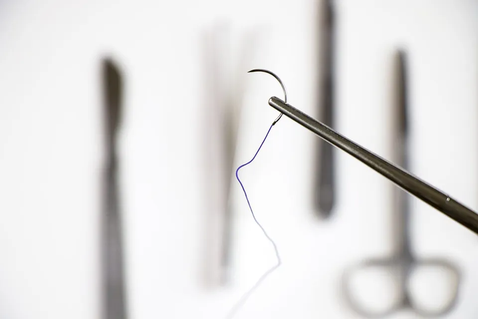 Surgical Staples vs. Sutures: A Technical Guide to Optimal Wound Closure Techniques