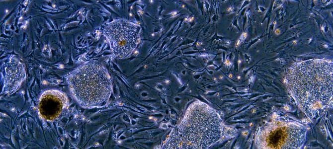 stem cells Dolphin Sutures