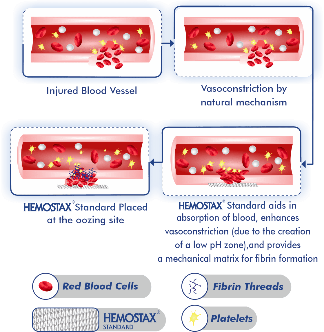 Hemostax-process Hemostax process Dolphin Sutures