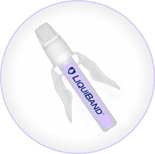 exceed 02 Dolphin Sutures